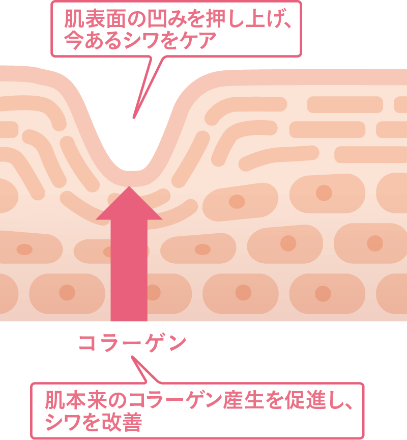 『ナイアシンアミド』が肌のへこみを押し上げ、表面化しているシワを改善