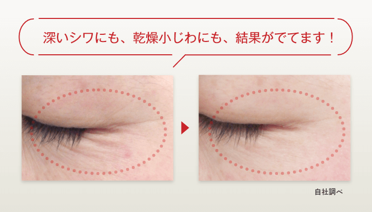 深いシワにも、乾燥小じわにも、結果がでてます!