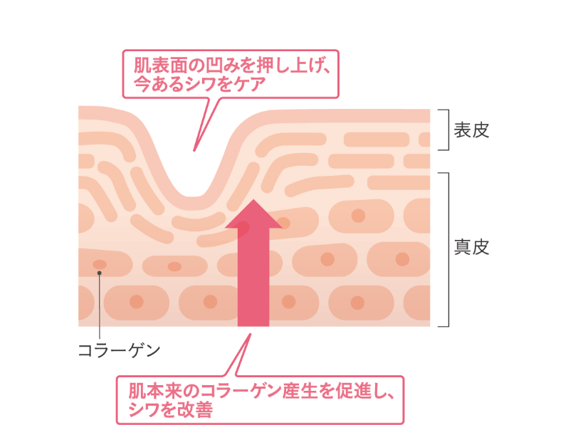 肌表面の凹みを押し上げ、今あるシワをケア 肌本来のコラーゲン産生を促進し、シワを改善