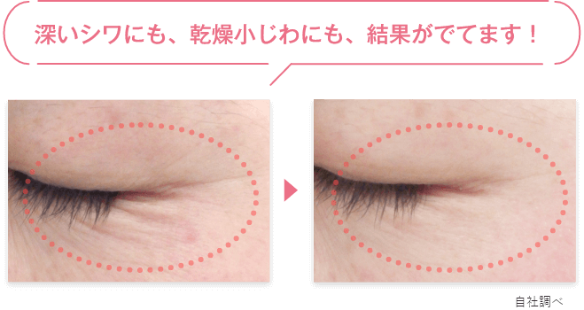 深いシワにも、乾燥小じわにも、結果がでてます!(自社調べ)